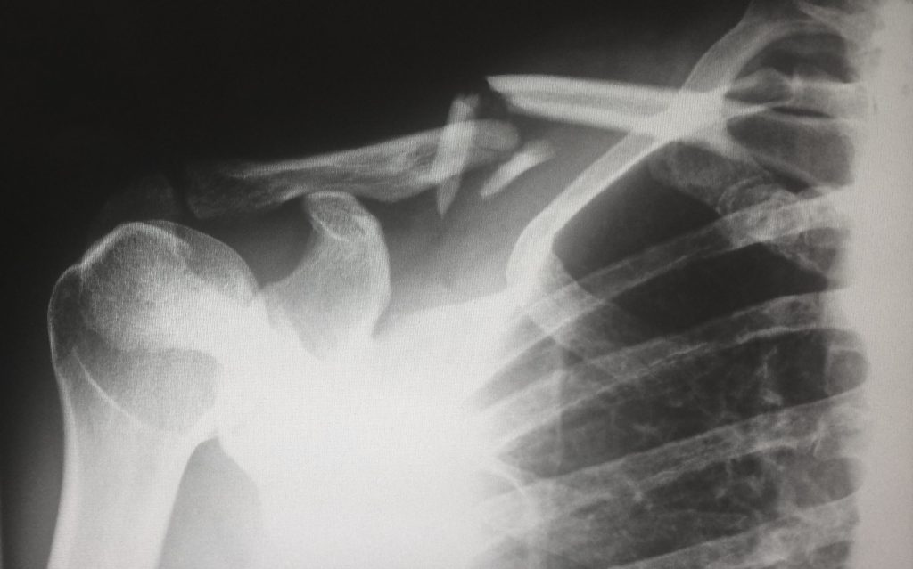 When Helping Hands Still Hurt – Part&nbsp;1